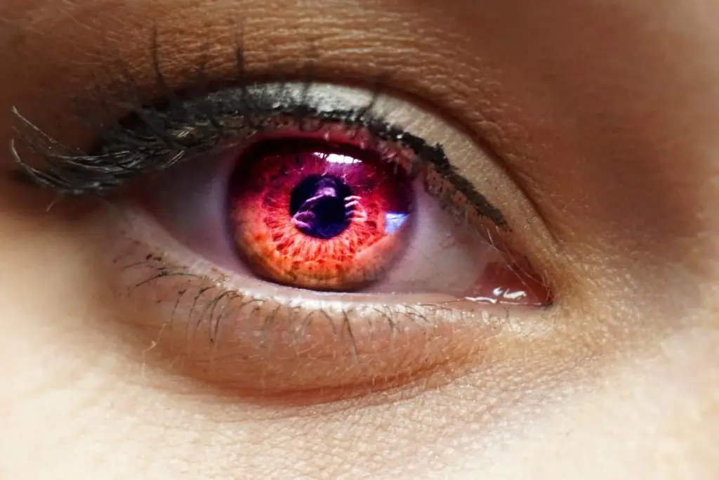 الحساسية في العيون