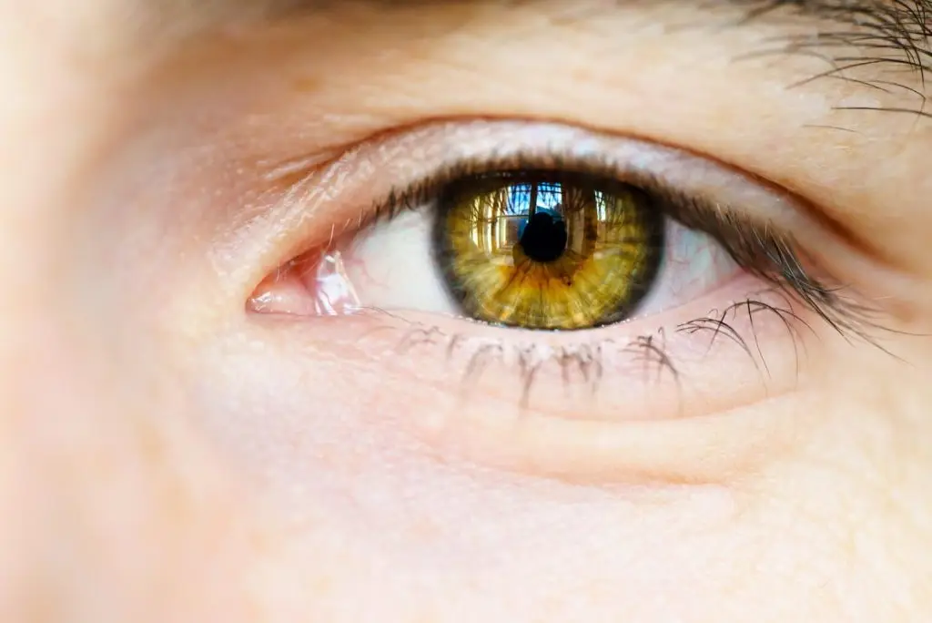 الهزات في العيون