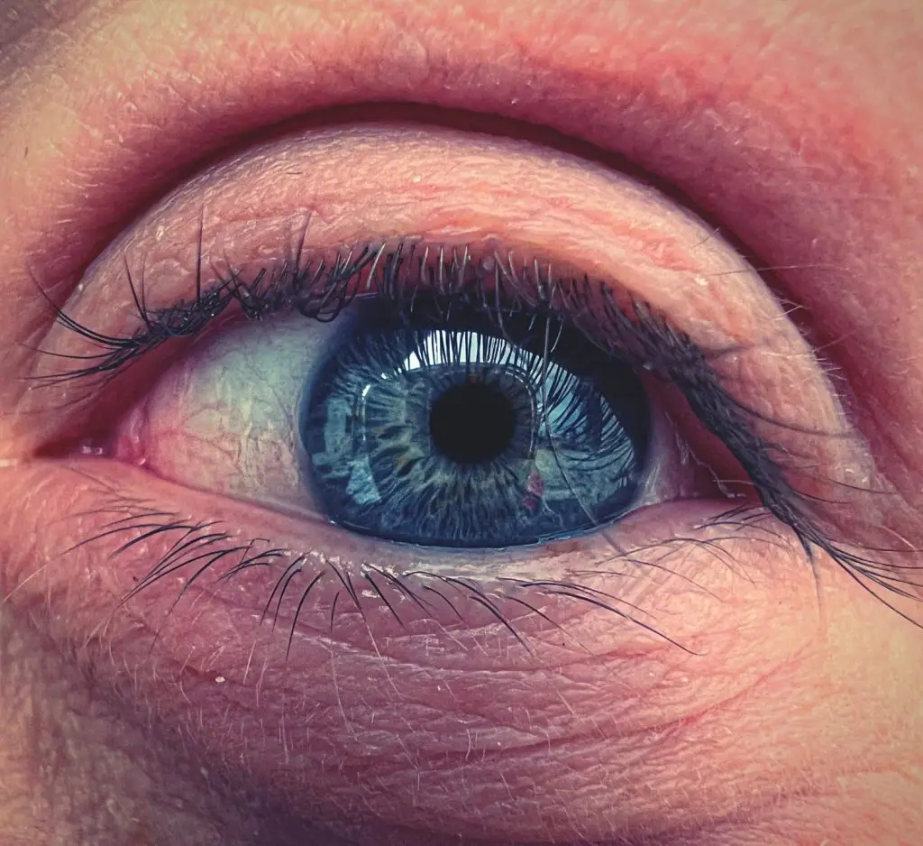 الشعير الداخلي في العين