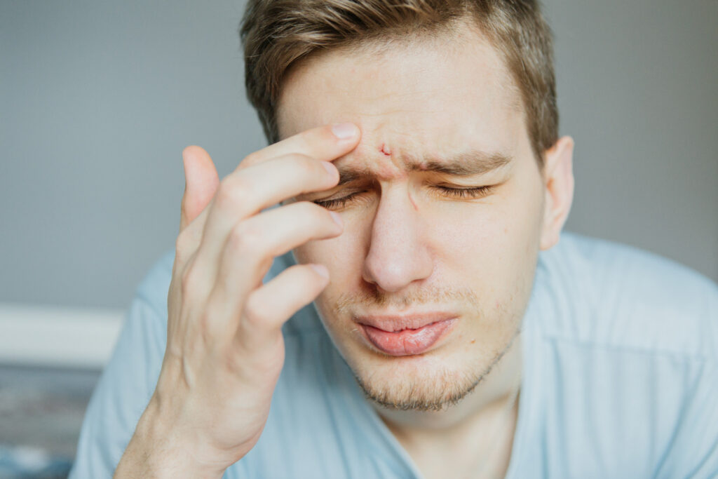 צריבה בעיניים